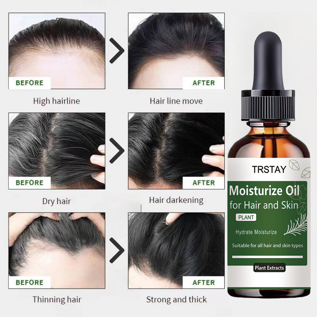 TRSTAY 로즈마리 에센셜 오일 모발 및 두피 강화  - Rosemary Hair Oil 리뷰 및 가격