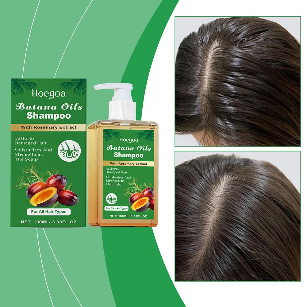 바타나 오일 & 로즈마리 샴푸, 100ML 로즈마리 추 - Rosemary Hair Oil 리뷰 및 가격