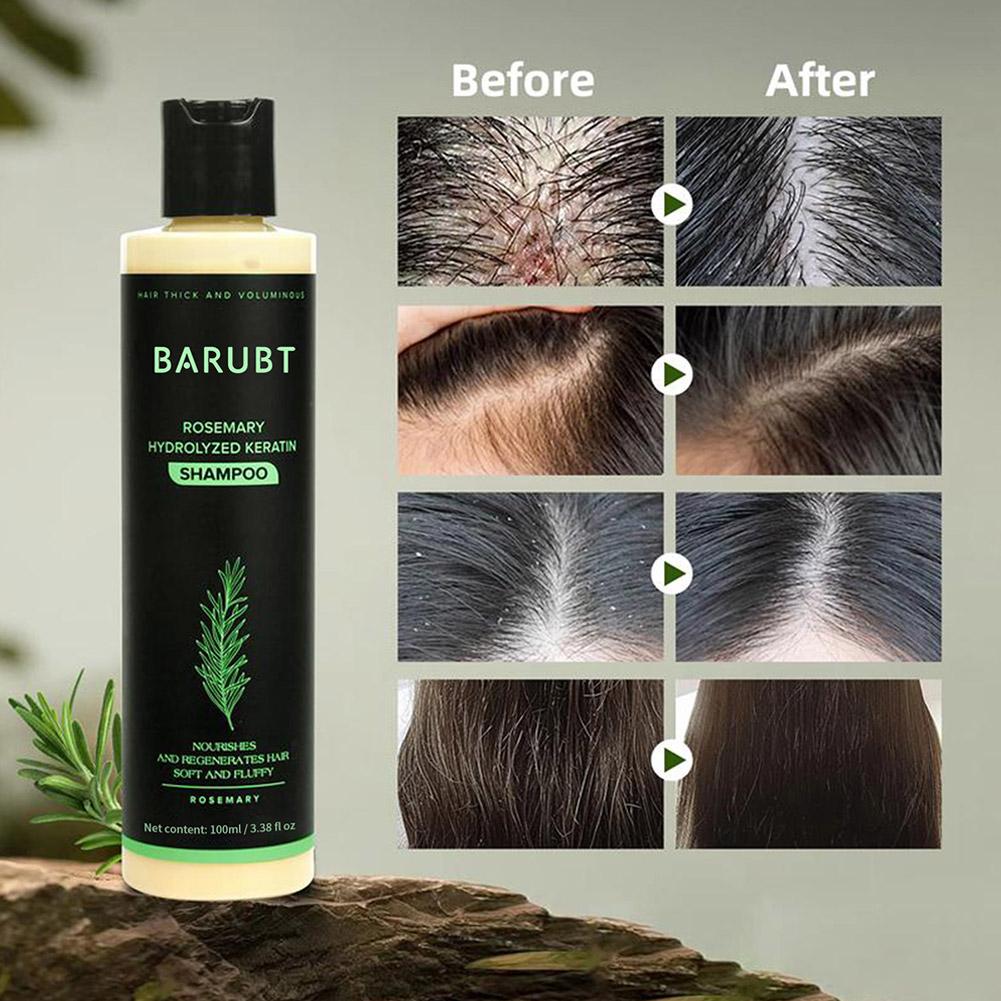 로즈마리 샴푸 모발 성장 딥 클렌징 두피 비듬 방지 유 - Rosemary Hair Oil 리뷰 및 가격